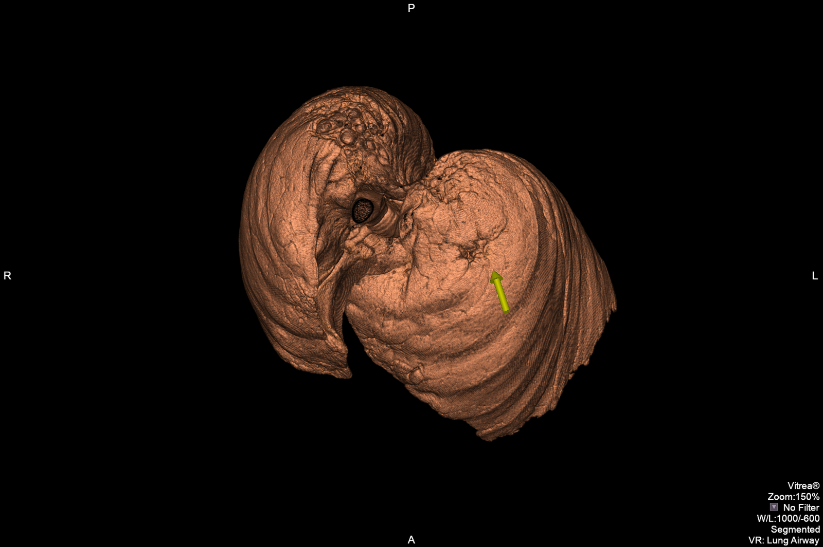 ayx体育官方网站-?X的简单介绍-ayx体育官方网站